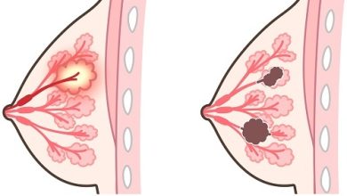 Photo of Значение медицинской аппаратуры
