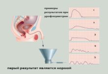 Photo of Что такое урофлоуметрия и её значение