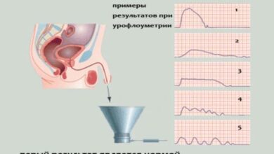 Photo of Что такое урофлоуметрия и её значение