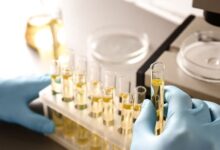 Photo of Общеклинические методы испытаний мочи