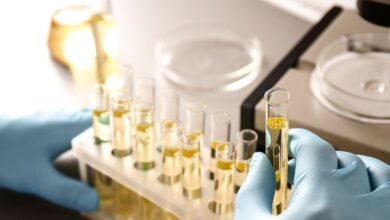 Photo of Общеклинические методы испытаний мочи