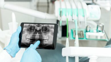 Photo of 1. Преимущества цифровой рентгенографии в стоматологии